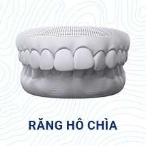răng hô chìa