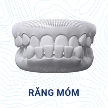 răng móm