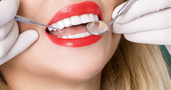 Dán răng sứ veneer có ăn nhai bình thường và bền không