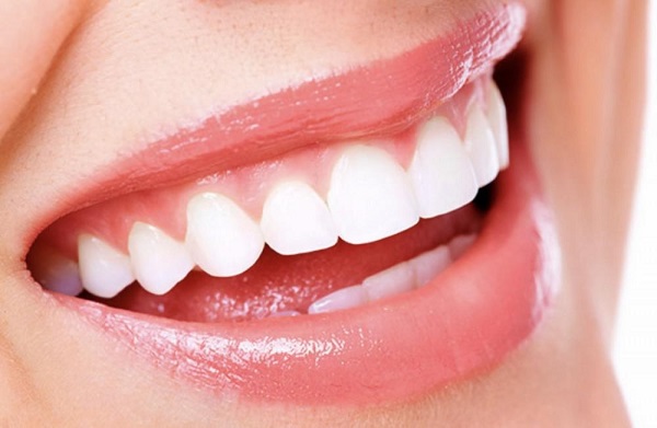 Nên dán veneer hay bọc răng sứ cho răng thưa