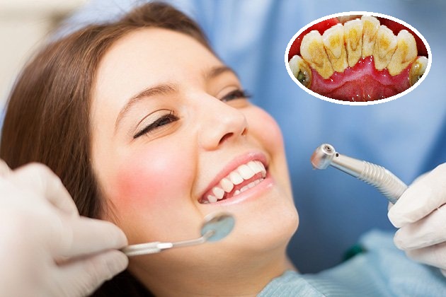 doi tuong lay cao rang