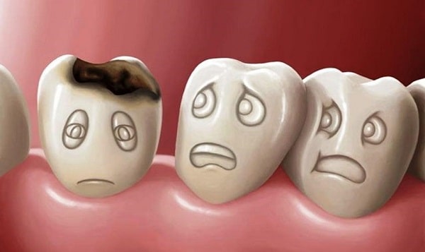Những lợi ích khi răng sâu được phát hiện và điều trị sớm
