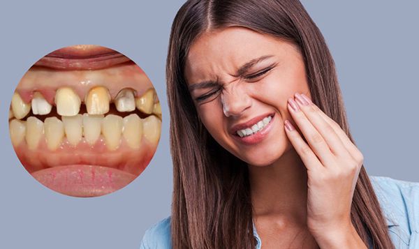 Cảm giác sau khi bọc răng sứ bị ê buốt