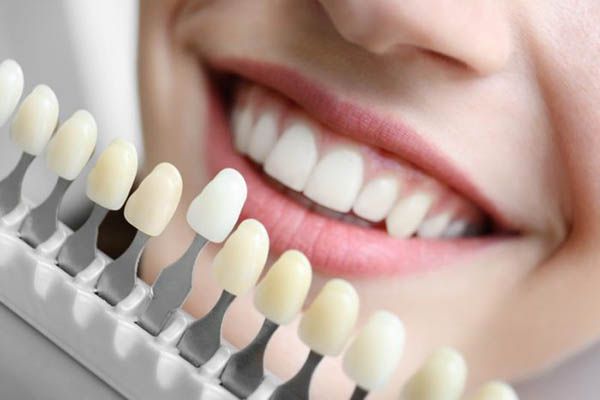 Răng sứ Zirconia màu Vita Classic